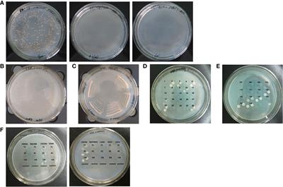 Anti-CXCR4 Single-Chain Variable Fragment Antibodies Have Anti-Tumor Activity